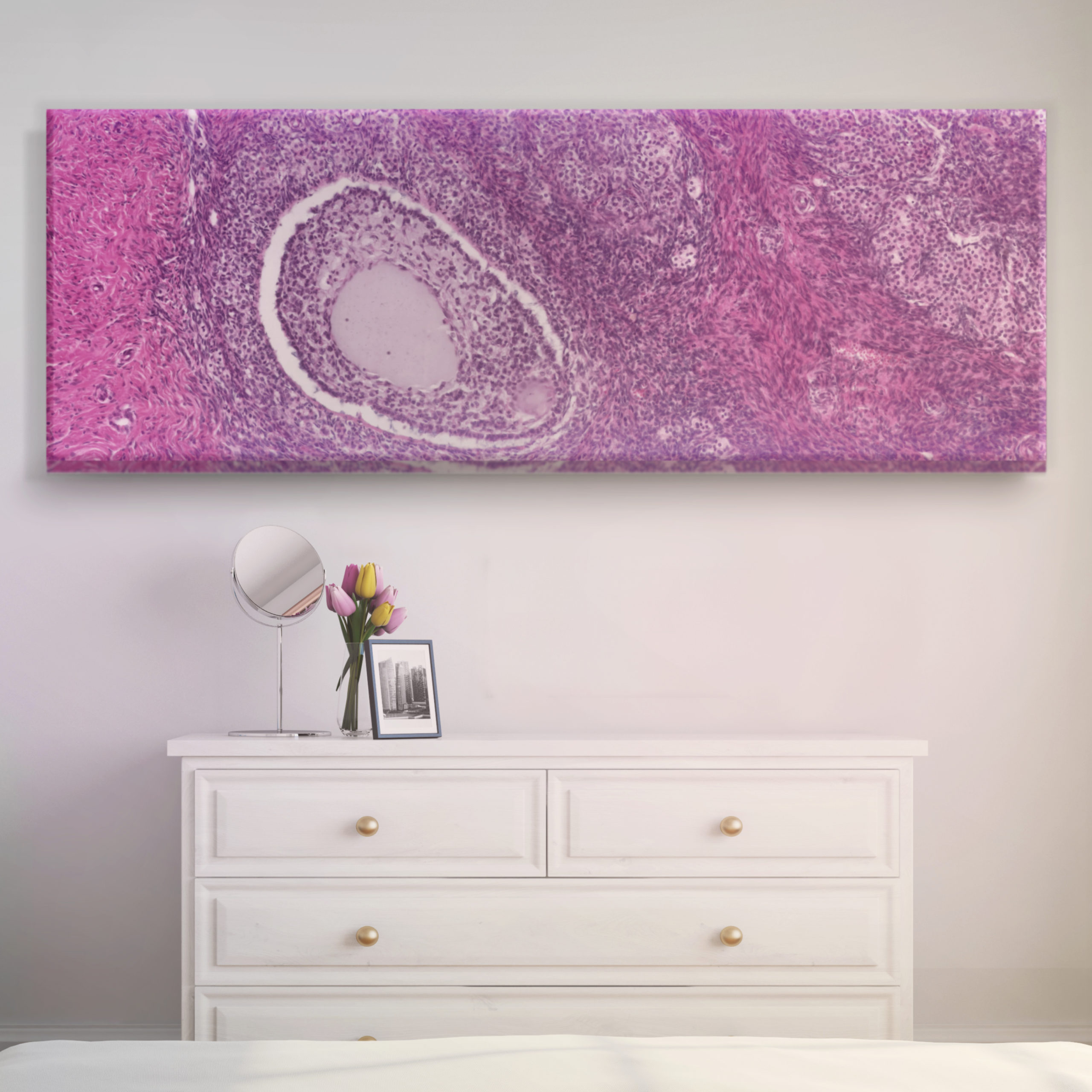 Oocyte of Ovary bedroom